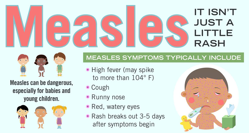 Measles Case Reported in Lea County